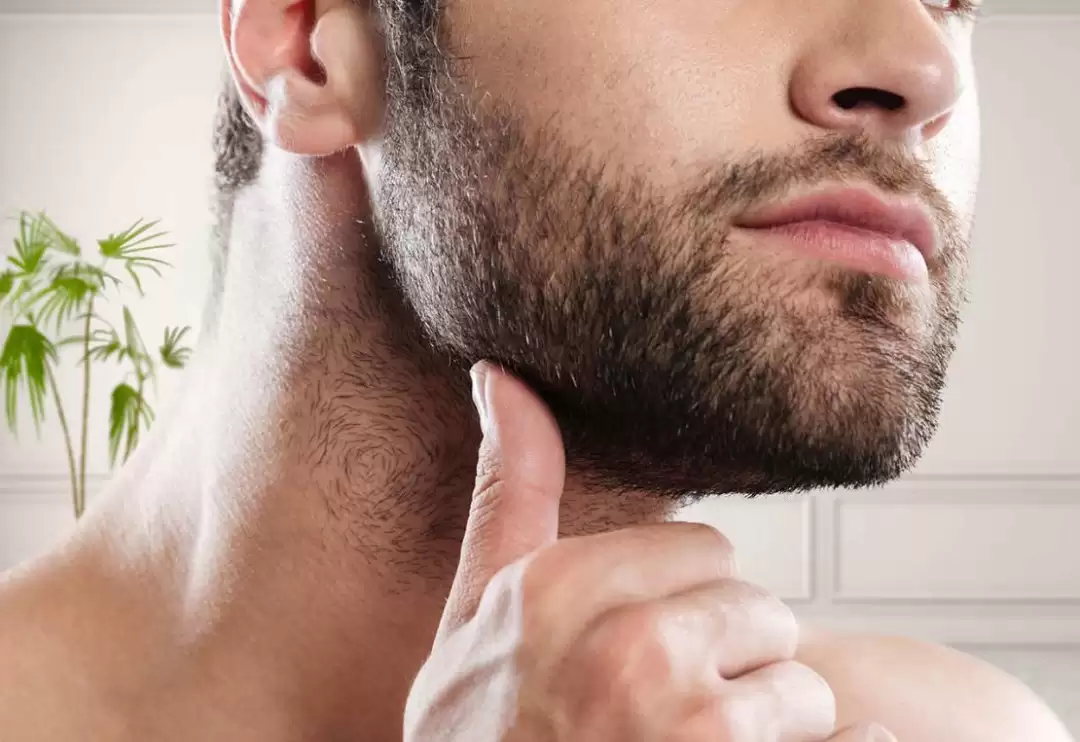 7 Benefits of a Beard Transplant